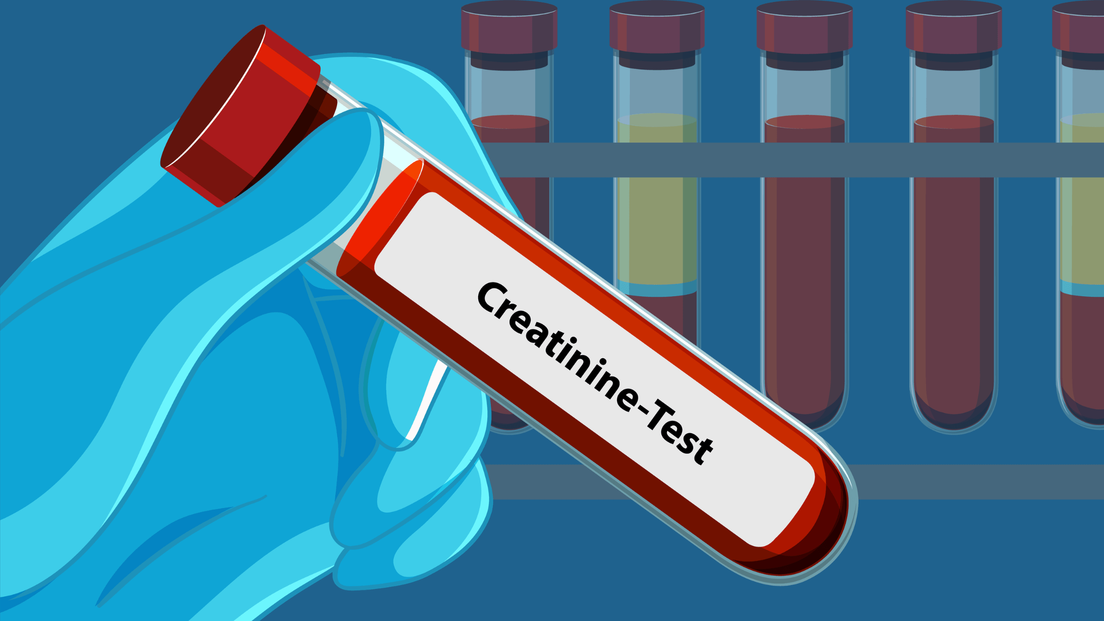 Leia mais sobre o artigo Creatinina alta e filtração baixa: o que os seus exames estão tentando lhe dizer?