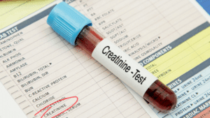 Leia mais sobre o artigo Creatinina “normal” pode esconder um problema sério: entenda por que o seu tamanho importa